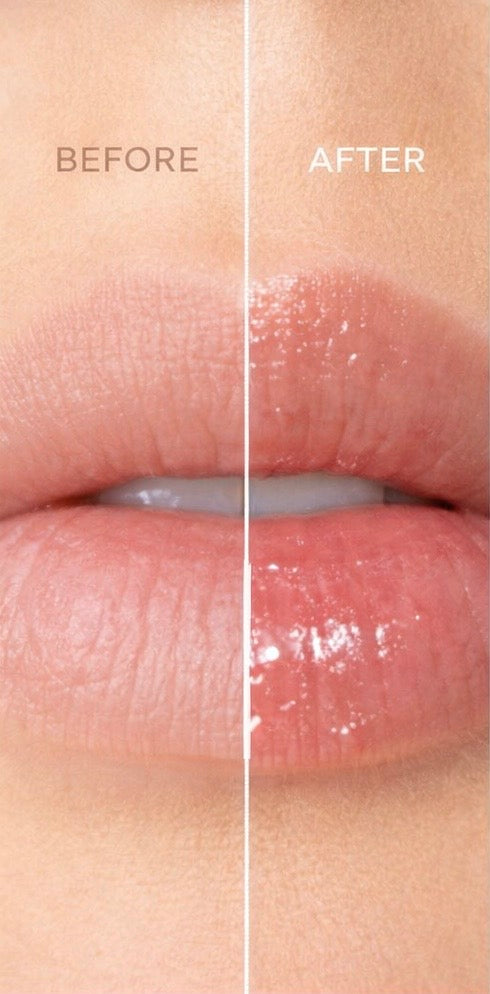Hot Balm